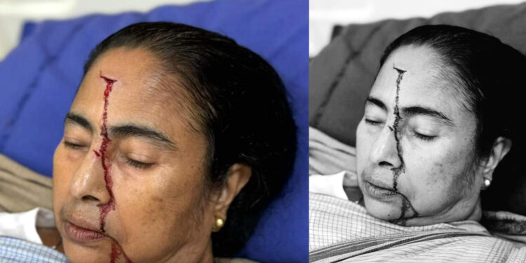ബംഗാൾ മുഖ്യമന്ത്രി മമത ബാനർജിയുടെ തലയ്ക്ക്; ഗുരുതര പരിക്ക്