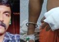 വിവാഹാലോചനയില്‍ നിന്ന് യുവതി പിന്‍മാറിയതിനെ തുടര്‍ന്ന് വീട് കയറി ആക്രമണം: 5 പേര്‍ക്ക് വെട്ടേറ്റു