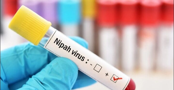 കോഴിക്കോട് സ്വകാര്യ ആശുപത്രിയില്‍ ചികിത്സയിലുള്ള 14കാരന് നിപ സ്ഥിരീകരിച്ചു