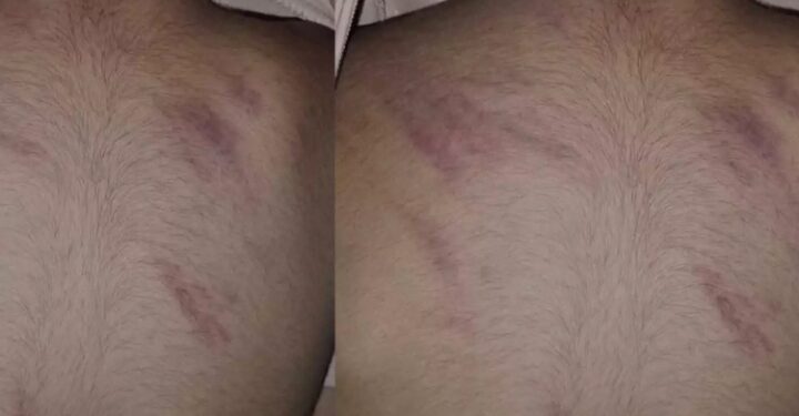 മട്ടാഞ്ചേരിയിൽ മൂന്നര വയസ്സുകാരന് അധ്യാപികയുടെ മർദ്ദനം: അധ്യാപികയെ പിരിച്ചുവിട്ടു